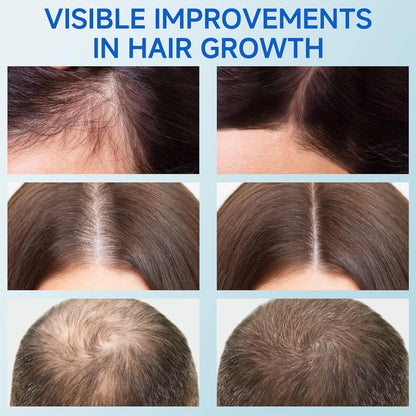 Hair Growth Herbal Rollerball Essence Scalp Massage Hair Care Essence