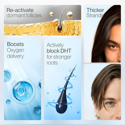Hair Growth Herbal Rollerball Essence Scalp Massage Hair Care Essence